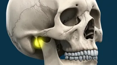 Illustration mastoid - Image 1