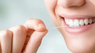 Illustration flosses - Image 1