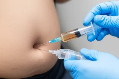 Illustration taps - Image 1