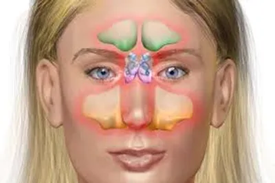 Illustration sinus - Image 2