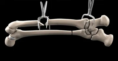 Illustration reduction - Image 1