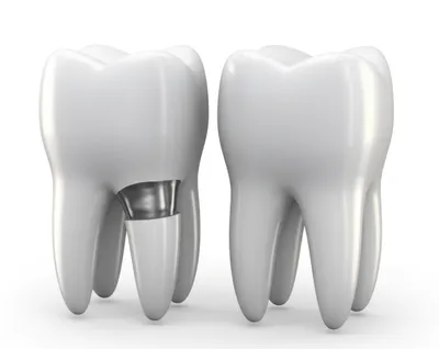 Illustration fillings - Image 1