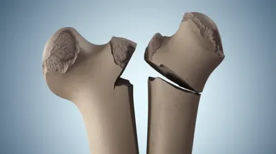 Illustration rode - Image 1