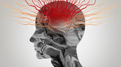 Illustration headaches