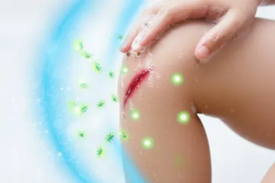 Illustration antiseptic - Image 1