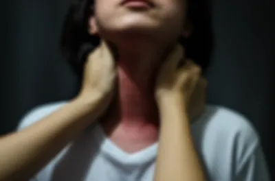 Illustration strangle - Image 1