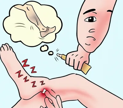 Illustration topical