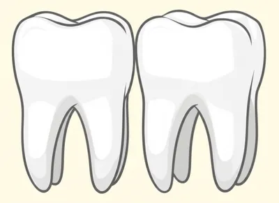 Illustration molar - Image 1