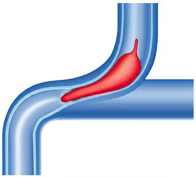 Illustration strictures - Image 1