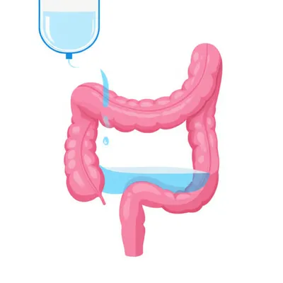 Illustration colonic - Image 1