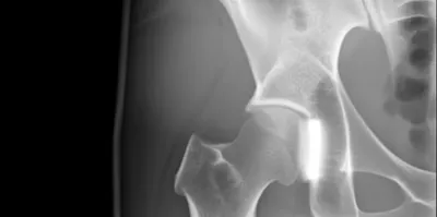 Illustration symphysis - Image 1