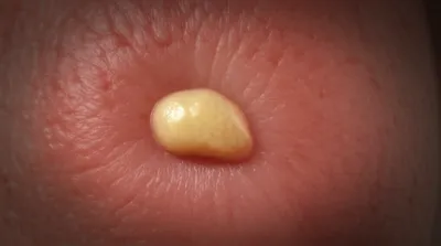 Illustration gathers - Image 1