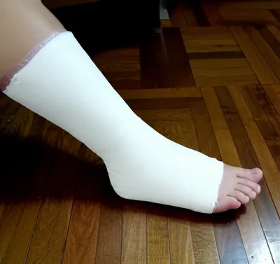 Illustration cast - Image 1