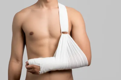 Illustration sling - Image 1