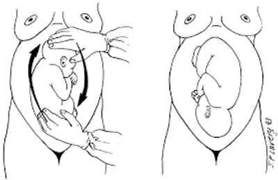 Illustration version - Image 3