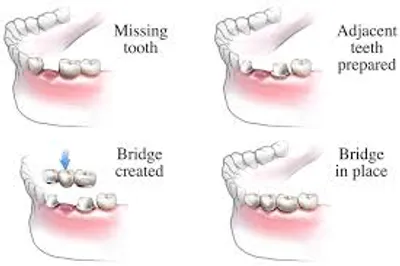 Illustration bridge - Image 3