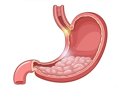 Illustration cardiac - Image 1