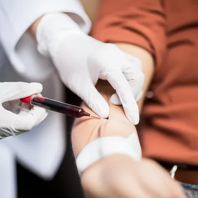 Illustration phlebotomise - Image 1