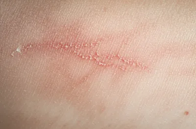 Illustration scars - Image 1