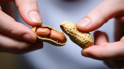 Illustration shelling - Image 1