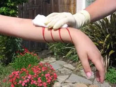 Illustration stanch - Image 2