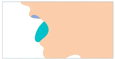 Illustration close - Image 1