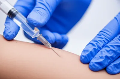 Illustration inject - Image 1