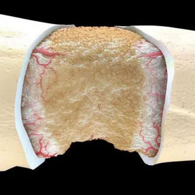 Illustration callus - Image 1