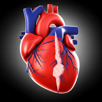 Illustration cardiac - Image 1
