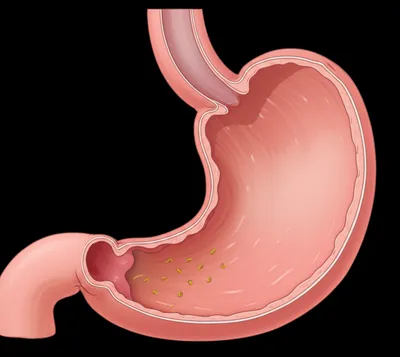 Illustration cardia - Image 1