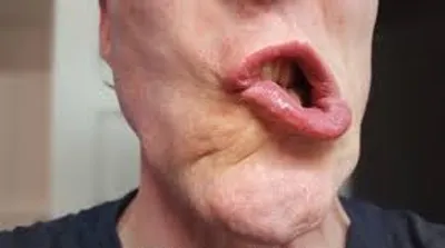 Illustration twisted - Image 2