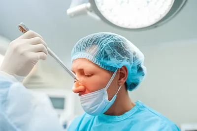 Illustration plastics - Image 1