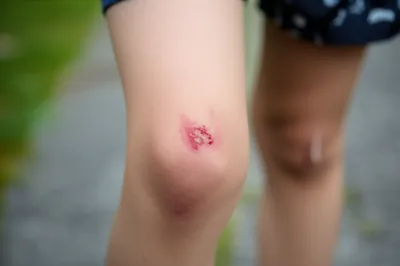 Illustration grazing - Image 1