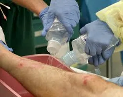 Illustration irrigate - Image 2