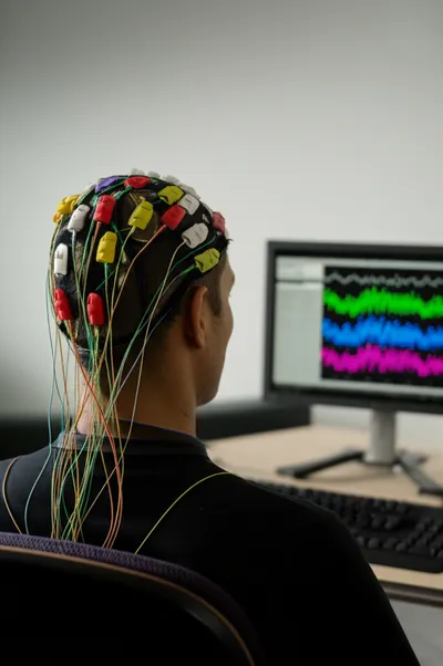 Illustration electroencephalogram