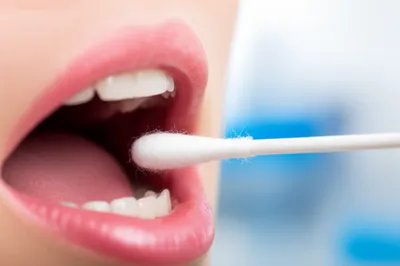 Illustration swab - Image 1