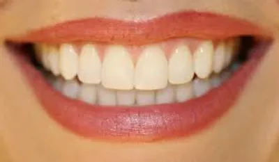 Illustration oral - Image 2