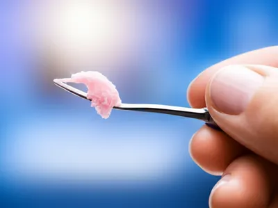 Illustration curette - Image 1