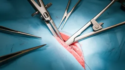 Illustration remora - Image 1