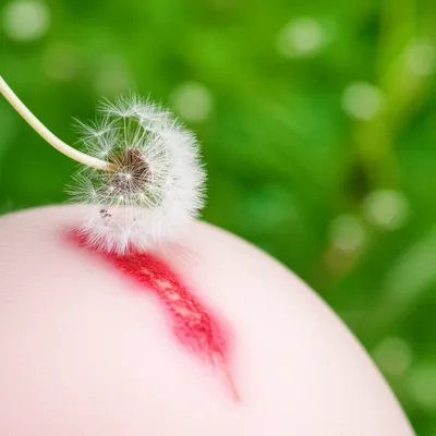 Illustration rase - Image 1