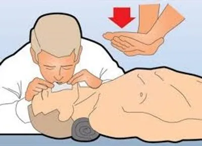 Illustration ventilate - Image 2