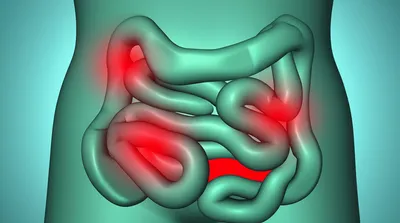 Illustration gripe - Image 1