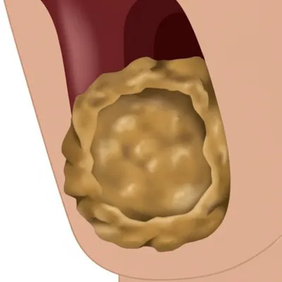 Illustration bole - Image 1