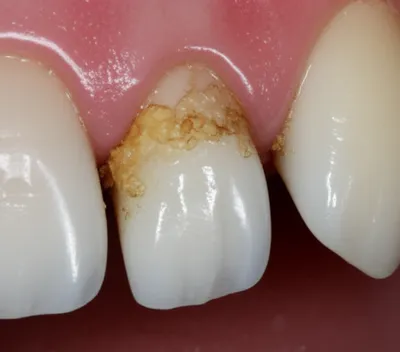 Illustration tartar - Image 1