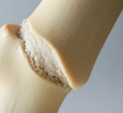 Illustration callous - Image 1