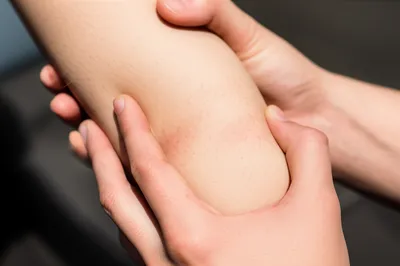 Illustration pinched - Image 1