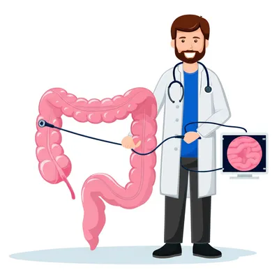 Illustration colonoscopy