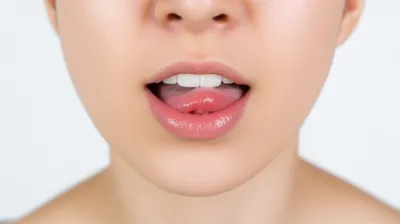 Illustration fronting - Image 1