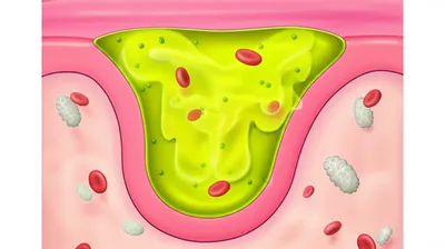 Illustration matter - Image 1