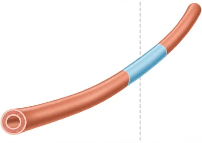 Illustration median - Image 1